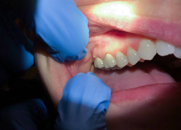 Best Cosmetic Emergency Dentistry in Wrightsboro, NC