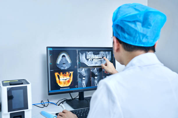 Best Emergency Wisdom Teeth Removal in Wrightsboro, NC
